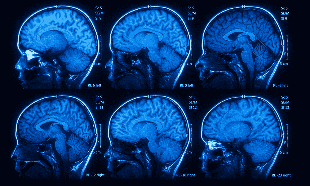 cérebro humano e conectividade na neurociência do comportamento
