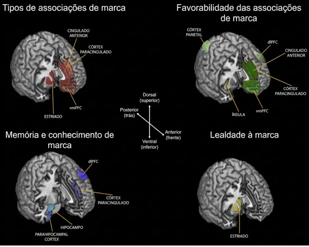 Imagem de ressonância magnética funcional (fMRI) mostrando a ativação de regiões cerebrais durante um experimento de neuromarketing sobre a influência das marcas nas decisões de consumo.